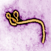 Ebola Virus (Photo: Courtesy Frederick Murphy)
